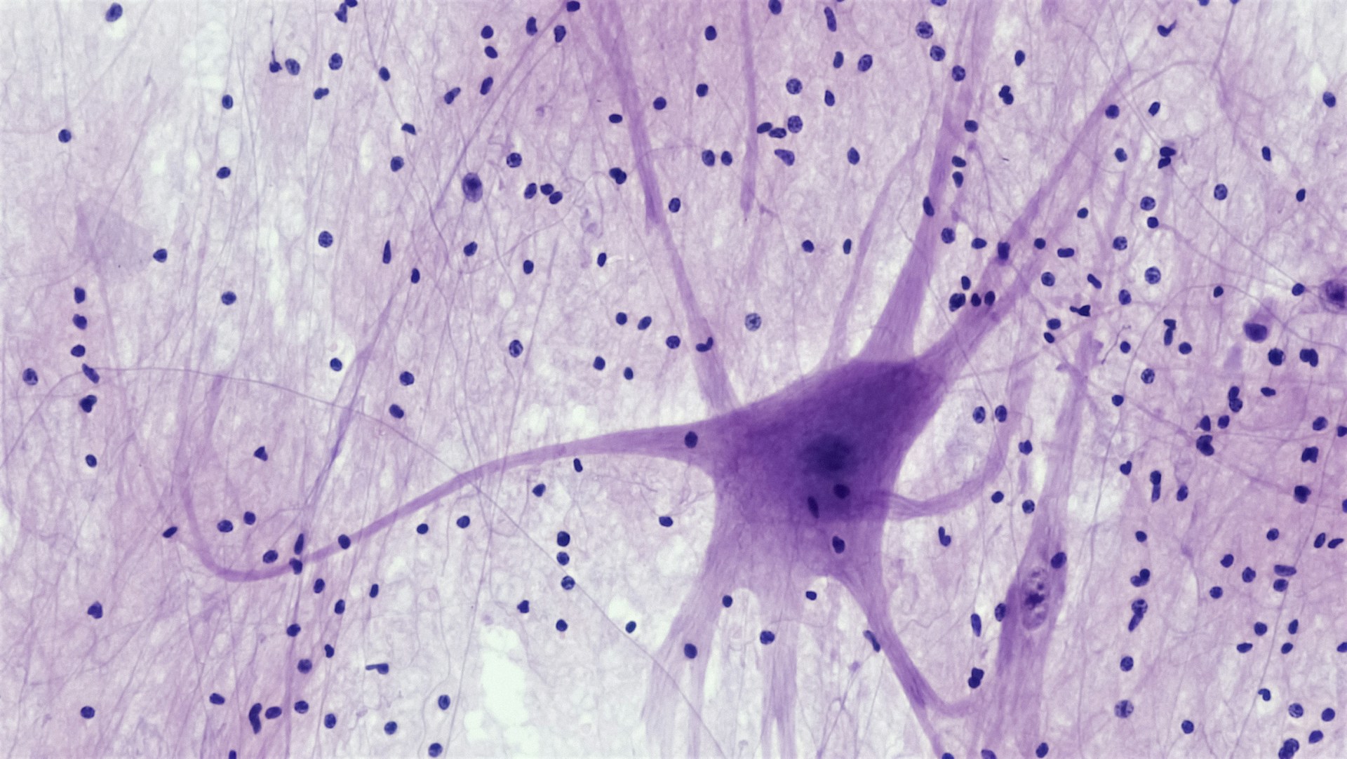 Neuron