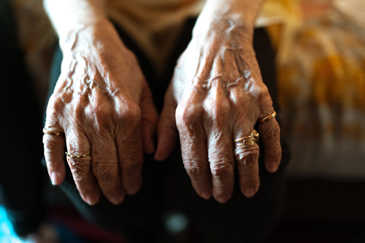 Idős kezek térden